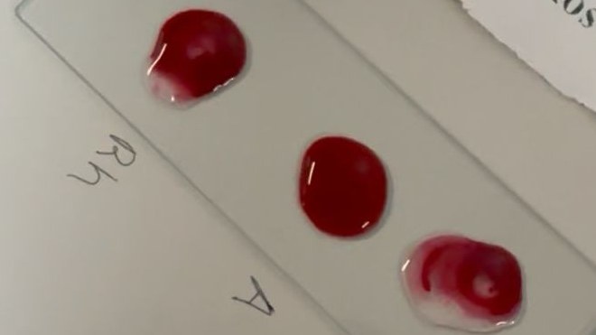 Lâmina de vidro com três gotas de sangue simulado, para os testes Rh, A e B
